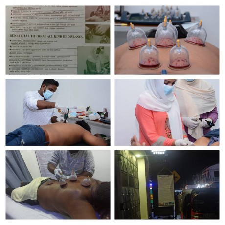 Nuzair's Hijama Cupping & Herbal Clinic